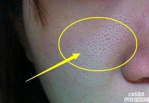 毛孔粗大怎么办？要知道毛孔粗大的原因