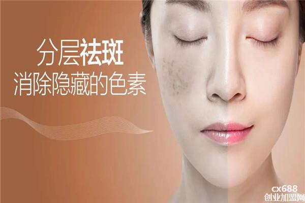 恒美时代祛斑加盟