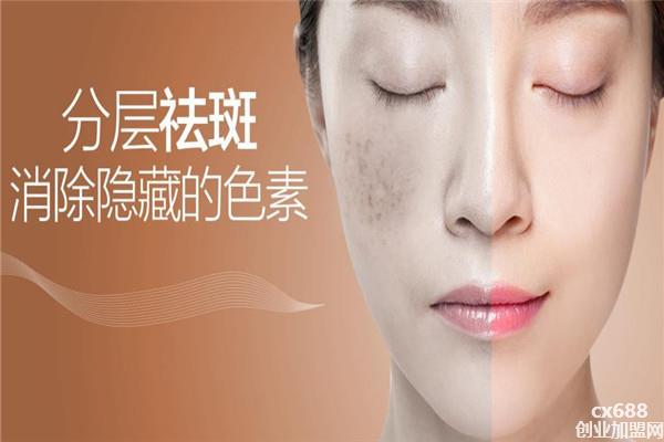 忆美时光祛斑加盟