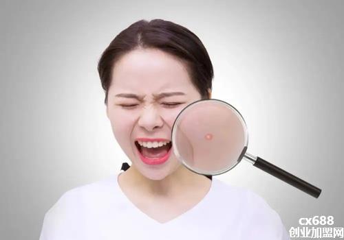 脸上长痘痘怎么办？网友分享长痘痘后的护肤小技巧